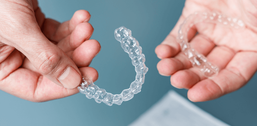 Overbite Correction with Clear Aligners