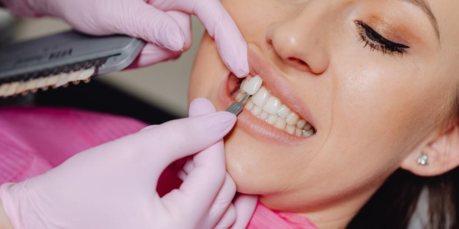Durability of Porcelain Veneers