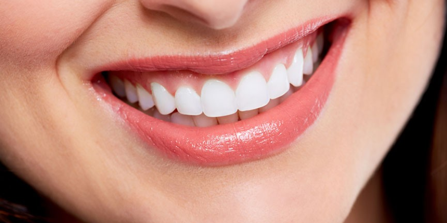 Smile Makeover Timeline