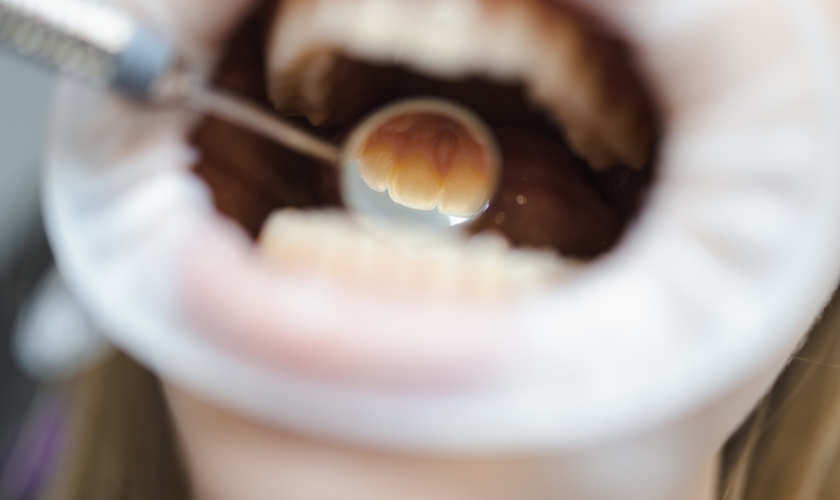 tooth-friendly dessert swaps for families in newton