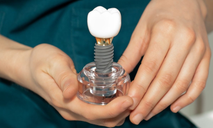 all-on-4/6 or traditional dental implants